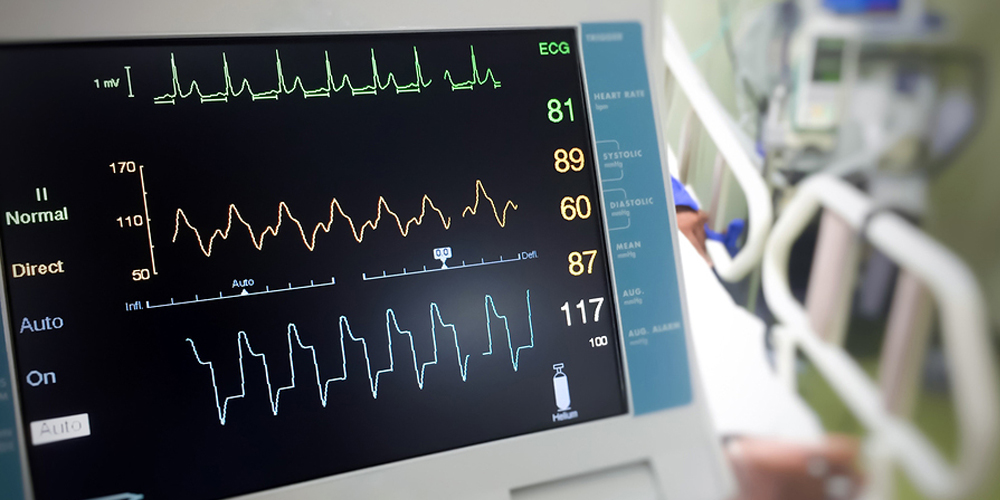 Electrocardiogram